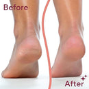 Hanglow Electric Callus Remover for Feet – Rechargeable Foot Dead Skin